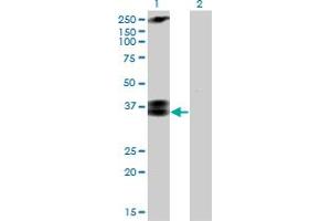 Western Blot analysis of CACNG3 expression in transfected 293T cell line by CACNG3 monoclonal antibody (M01), clone 3E4.