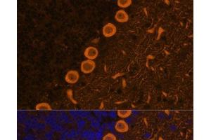 Immunofluorescence analysis of Rat brain cells using PRKCG Polyclonal Antibody at dilution of 1:100. (PKC gamma anticorps)