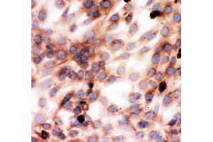 Anti-Gelsolin antibody, ICC ICC: NIH3T3 Cell