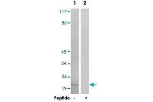 Western blot analysis of extracts from HT-29 cells, using PPP1R14A polyclonal antibody . (CPI-17 anticorps)