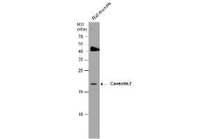 WB Image Caveolin 2 antibody detects Caveolin 2 protein by western blot analysis.