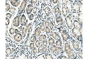 IHC analysis of DROSHA using anti-DROSHA antibody (ABIN7599763).