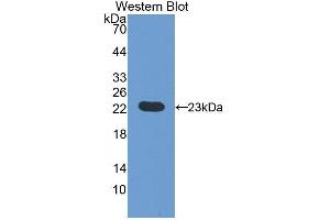 Detection of Recombinant vHL, Rat using Polyclonal Antibody to Von Hippel Lindau Tumor Suppressor (vHL) (VHL anticorps  (AA 6-175))