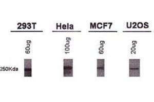 Western blot analysis of BRCA1 using BRCA1 monoclonal antibody, clone KEN . (BRCA1 anticorps  (AA 1314-1864))