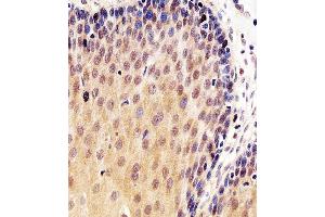 Immunohistochemical analysis of paraffin-embedded H. (p53 anticorps  (AA 364-393))