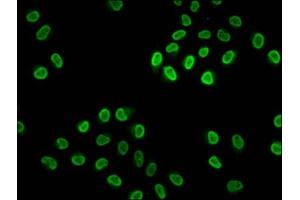 Immunofluorescence staining of Hela cells (treated with 30mM sodium butyrate for 4h) with ABIN7139171 at 1:2.