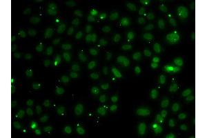 Immunofluorescence analysis of A549 cell using NSL1 antibody. (NSL1 anticorps)