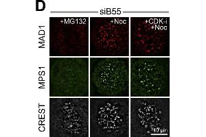 PP2A-B55 counteracts CDK1-dependent MPS1 localization to kinetochores and checkpoint signaling.