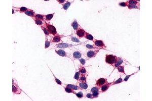 Anti-CD97 antibody immunocytochemistry (ICC) staining of HEK293 human embryonic kidney cells transfected with CD97. (CD97 anticorps  (N-Term))