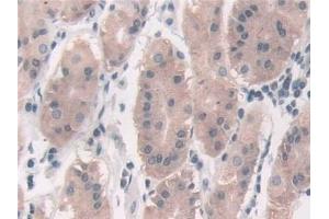 Detection of FUT6 in Human Stomach Tissue using Polyclonal Antibody to Fucosyltransferase 6 (FUT6)