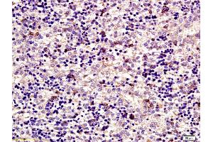 Formalin-fixed and paraffin embedded mouse embryo labeled with Anti ABCF1 Polyclonal Antibody, Unconjugated (ABIN675938) at 1:200 followed by conjugation to the secondary antibody and DAB staining