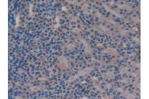 IHC-P analysis of Mouse Kidney Tissue, with DAB staining. (Versican anticorps  (AA 3058-3299))