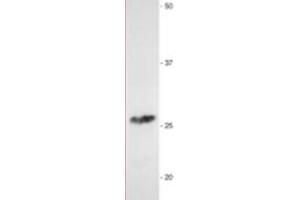 Western Blotting (WB) image for anti-Myelin Protein Zero (MPZ) antibody (ABIN953494)