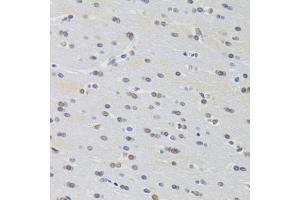 Immunohistochemistry of paraffin-embedded rat brain using PRPF3 Antibody (ABIN5973192) at dilution of 1/100 (40x lens). (PRPF3 anticorps)