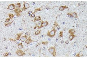 Immunohistochemistry of paraffin-embedded Rat brain using TBCB Polyclonal Antibody at dilution of 1:100 (40x lens).