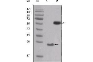 Western Blot showing SRC antibody used against truncated SRC-His recombinant protein (1) and PMA treated THP-1 cell lysate (2). (Src anticorps  (AA 10-193))