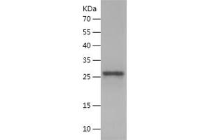 Western Blotting (WB) image for Retinitis Pigmentosa GTPase Regulator (RPGR) (AA 19-242) protein (His tag) (ABIN7124841)