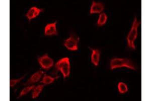 ABIN6272421 staining RAW264. (RSU1 anticorps  (C-Term))