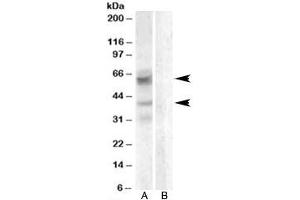 Western blot testing of A459 lysate with Arylsulfatase D antibody with [B] and without [A] blocking/immunizing peptide. (Arylsulfatase D anticorps)