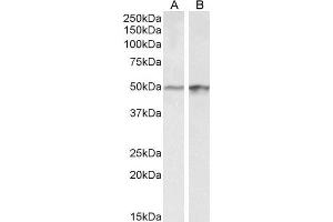 ABIN1590023 (0. (E2F4 anticorps  (Internal Region))