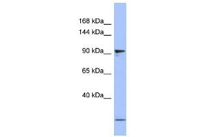 PSMD1 antibody used at 1 ug/ml to detect target protein. (PSMD1 anticorps)