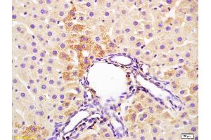Formalin-fixed and paraffin embedded rat liver labeled with Anti-IL-3 Polyclonal Antibody, Unconjugated (ABIN747788) at 1:200 followed by conjugation to the secondary antibody and DAB staining (IL-3 anticorps  (AA 101-166))