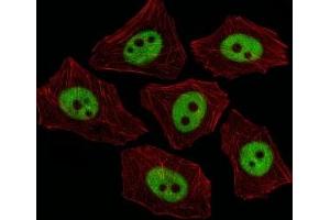 Immunofluorescent analysis of A549 cells using XRCC1 antibody at 1:25.