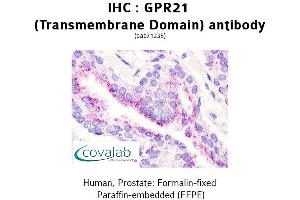 Image no. 1 for anti-G Protein-Coupled Receptor 21 (GPR21) antibody (ABIN1735029) (GPR21 anticorps)