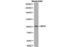 Western Blotting (WB) image for anti-Wolfram Syndrome 1 (WFS1) antibody (ABIN1875347) (WFS1 anticorps)