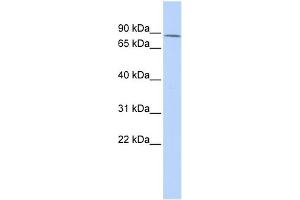 WB Suggested Anti-ZNF667 Antibody Titration:  0. (ZNF667 anticorps  (Middle Region))