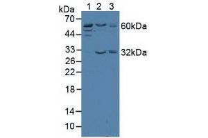 Western blot analysis of (1) Human Jurkat Cells, (2) Human HeLa cells and (3) Human K562 Cells. (TRF2 anticorps  (AA 144-438))