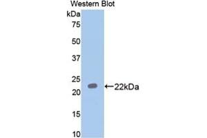 Detection of Recombinant PON1, Rat using Polyclonal Antibody to Paraoxonase 1 (PON1)