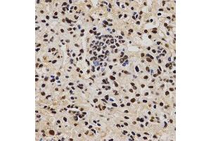 Immunohistochemistry (IHC) image for anti-Proline-, Glutamic Acid- and Leucine-Rich Protein 1 (PELP1) (AA 1021-1180) antibody (ABIN3023502) (PELP1 anticorps  (AA 1021-1180))