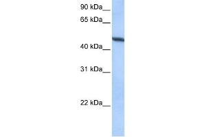 WB Suggested Anti-ADAM33 Antibody Titration:  0. (ADAM33 anticorps  (Middle Region))