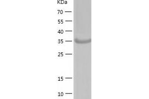 Western Blotting (WB) image for Acyl-CoA Thioesterase 7 (ACOT7) (AA 1-370) protein (His-IF2DI Tag) (ABIN7121687)