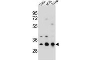 Western Blotting (WB) image for anti-Tropomyosin 4 (TPM4) antibody (ABIN2996933) (Tropomyosin 4 anticorps)