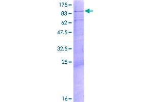 Image no. 1 for Mediator Complex Subunit 17 (MED17) (AA 1-651) protein (GST tag) (ABIN1310641)