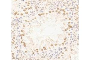 Immunohistochemistry analysis of paraffin-embedded rat testis using,PSIP1 (ABIN7074997) at dilution of 1: 3000 (PSIP1 anticorps)