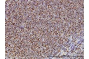 Image no. 1 for anti-Adducin 1 (Alpha) (ADD1) (AA 1-663) antibody (ABIN598527) (alpha Adducin anticorps  (AA 1-663))