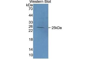 Detection of Recombinant NAGa, Human using Polyclonal Antibody to N-Acetylgalactosaminidase Alpha (NAGa) (NAGA anticorps  (AA 18-217))