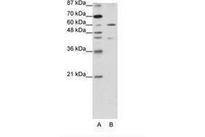 Image no. 1 for anti-Zinc Finger Protein 496 (ZNF496) (N-Term) antibody (ABIN202790) (ZNF496 anticorps  (N-Term))