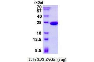 Figure annotation denotes ug of protein loaded and % gel used. (PGPEP1 Protéine)