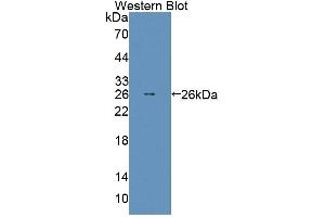 Detection of Recombinant ABCD2, Mouse using Polyclonal Antibody to ATP Binding Cassette Transporter D2 (ABCD2) (CCL17 anticorps  (AA 501-695))