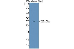 Detection of Recombinant ABCD2, Mouse using Polyclonal Antibody to ATP Binding Cassette Transporter D2 (ABCD2) (Abcd2 anticorps  (AA 501-695))