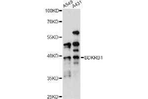 Western blot analysis of extracts of various cell lines, using BDKRB1 antibody (ABIN6290094) at 1:1000 dilution.