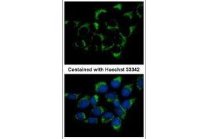 ICC/IF Image Immunofluorescence analysis of methanol-fixed A431, using CMG1, antibody at 1:500 dilution. (IFT74 anticorps  (C-Term))