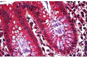 Human Colon, Epithelium: Formalin-Fixed, Paraffin-Embedded (FFPE)