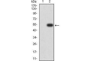 Western blot analysis using CTNNA1 mAb against HEK293 (1) and CTNNA1 (AA: 371-574)-hIgGFc transfected HEK293 (2) cell lysate.