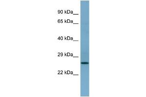 WB Suggested Anti-APIP  Antibody Titration: 0. (APIP anticorps  (Middle Region))