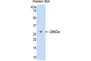 Detection of Recombinant CYP2D6, Human using Polyclonal Antibody to Cytochrome P450 2D6 (CYP2D6)